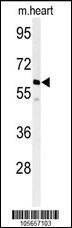 Anti-PPM1G (Center) Antibody
