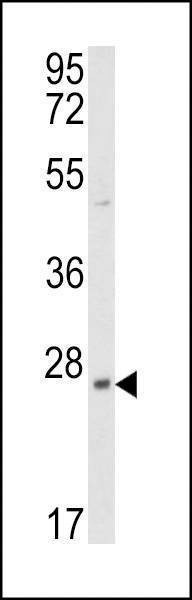 Anti-PRL3 Antibody