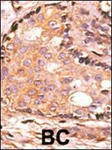 Anti-DUSP4 (C-term) Antibody