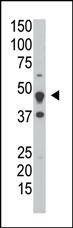 Anti-DUSP6 (Center) Antibody