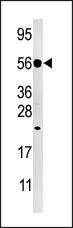 Anti-DUSP8 (C-term) Antibody
