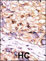 Anti-CTDSP1-V250 (C-term) Antibody
