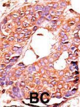 Anti-PPP6C (N-term) Antibody