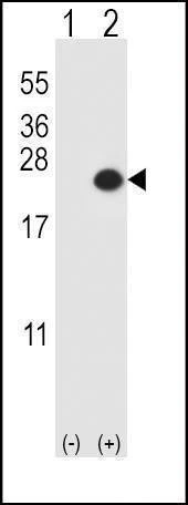 Anti-DUSP3 (N-term) Antibody