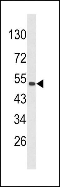 Anti-CKIP-1 (N-term) Antibody