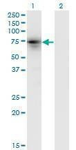 Anti-KLHL4 Antibody