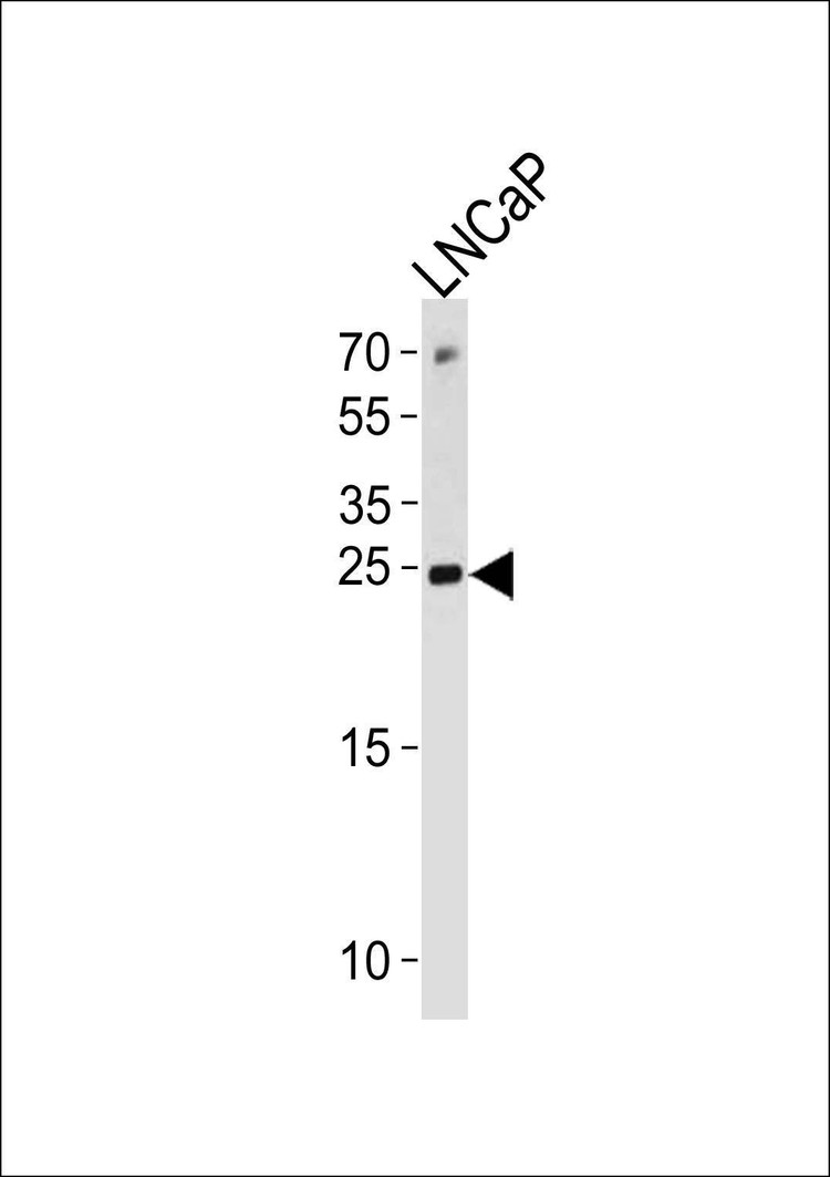 Anti-TPT1 (Center) Antibody