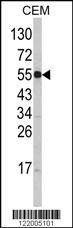 Anti-SLC11A1 (Center) Antibody