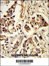 Anti-ARHGAP18 (Center) Antibody