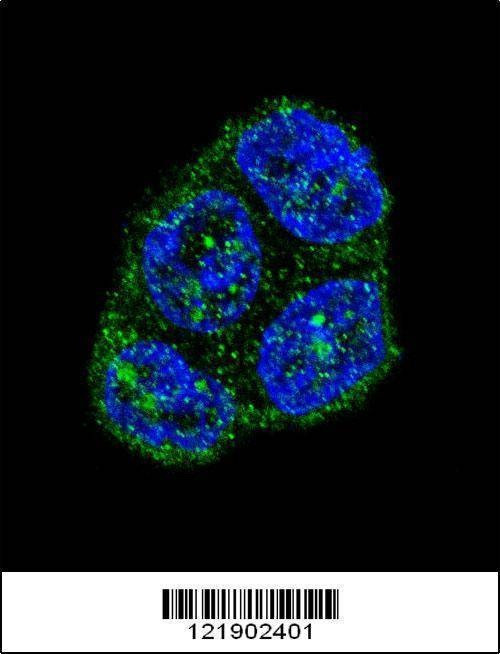 Anti-FAS (Center) Antibody