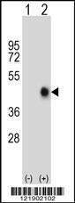Anti-FAS (Center) Antibody