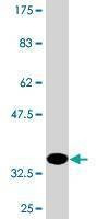 Anti-KLK4 Antibody