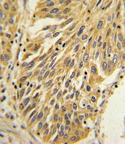 Anti-IL1B (Center) Antibody