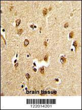 Anti-ABI1 (N-term) Antibody