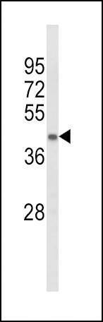 Anti-ACADL (Center) Antibody