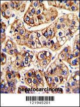 Anti-IFNAR1 (Center) Antibody