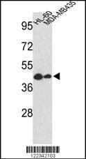 Anti-GSDMB (Center) Antibody