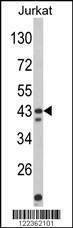 Anti-CECR5 (Center) Antibody