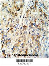 Anti-CECR5 (Center) Antibody
