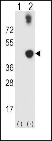 Anti-ADH5 (Center) Antibody