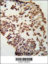 Anti-RB1 (C-term) Antibody