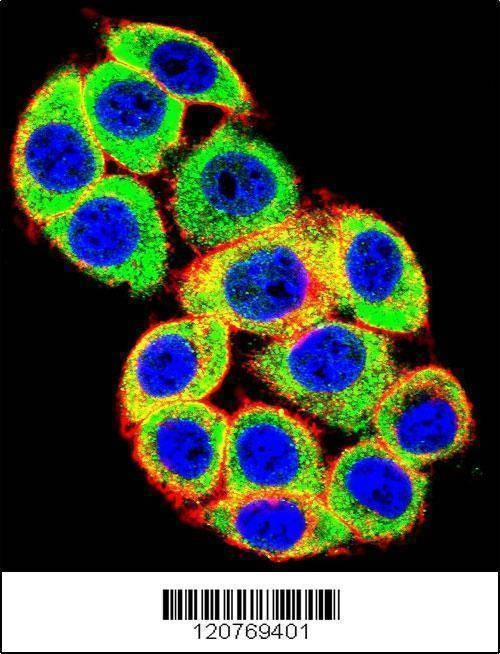 Anti-PRKCA (N-term) Antibody