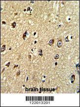 Anti-ABCC5 (Center) Antibody