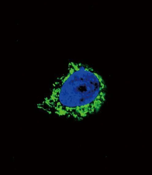 Anti-IGFBP2 (C-term) Antibody