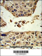Anti-HPD (C-term) Antibody