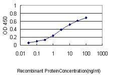 Anti-KNTC2 Antibody