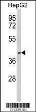 Anti-PON3 (N-term) Antibody