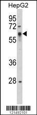 Anti-SRC (Y419) Antibody