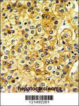 Anti-SRC (Y419) Antibody