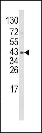 Anti-WNT5B (Center) Antibody