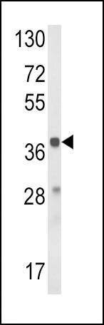 Anti-HAO1 (Center) Antibody