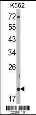 Anti-RNF5 (N-term) Antibody