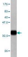 Anti-KREMEN1 Antibody