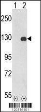Anti-PTK2 (C-term) Antibody