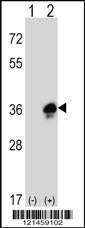 Anti-MPZ (C-term) Antibody