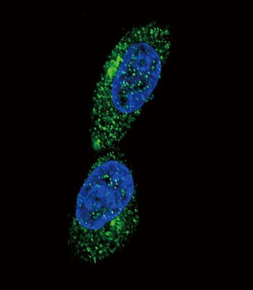 Anti-MICA (Center) Antibody