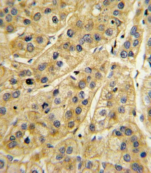 Anti-MICA (Center) Antibody