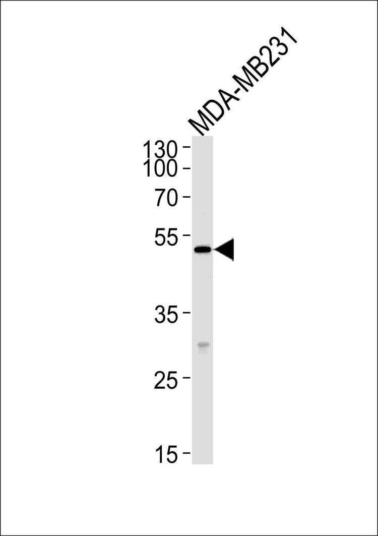 Anti-MICA (Center) Antibody