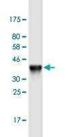 Anti-KRT24 Antibody