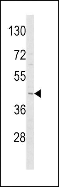Anti-ADIPOR1 (C-term) Antibody