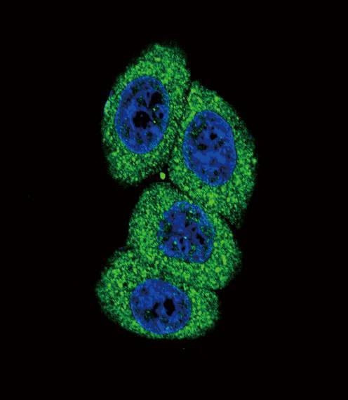 Anti-CYP4B1 (Center) Antibody