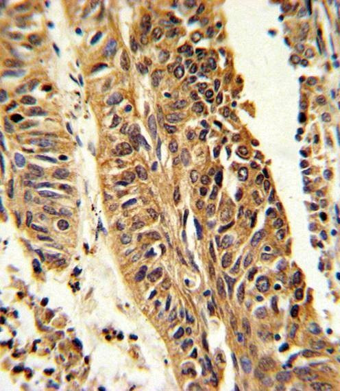 Anti-CYP4B1 (Center) Antibody