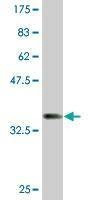 Anti-KRTHA4 Antibody