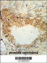 Anti-DSC1 (C-term) Antibody