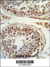 Anti-ITGB3 (C-term) Antibody
