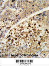 Anti-NR1I2 (Center) Antibody